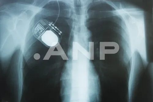 How a Delft Semiconductor Could Cure Diseases — and Why Western Medicine Isn't Moving Fast Enough